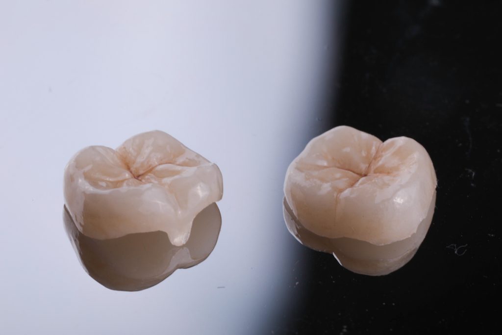 高硬度陶瓷，用心打造出每一顆細緻、擬真的瓷牙，還您健康、年輕、宛如新生的牙齒。