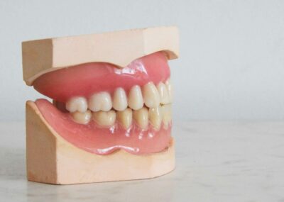 缺牙不補會怎樣？全口牙齒重建療程介紹，解決大量缺牙困擾