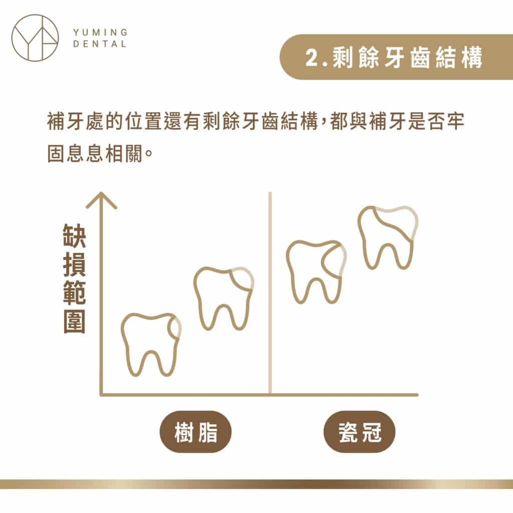 補牙是否穩固，都與 補牙 處的剩餘牙齒結構息息相關