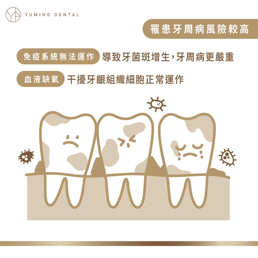 抽菸導致罹患牙周病的風險增高