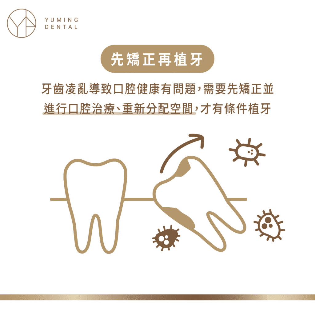 ▲有牙周問題的患者必須先處理口腔健康問題，降低後續矯正失敗機率