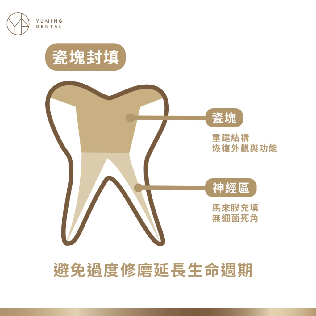 利用瓷塊封填恢復牙齒外觀結構與功能