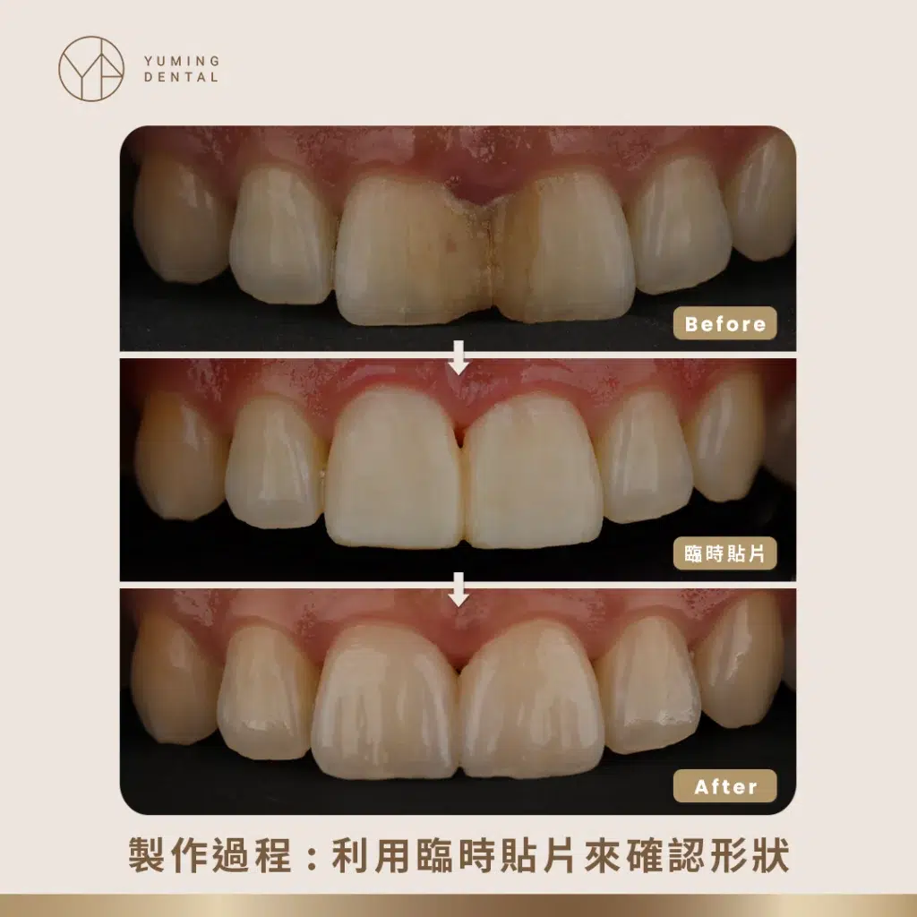 陶瓷貼片製作過程