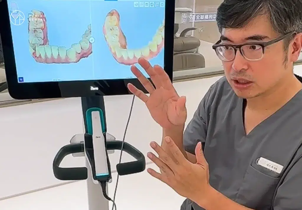 隱適美Lite是什麼？隱適美Lite可以處理哪些狀況？一篇帶你認識什麼是微矯正